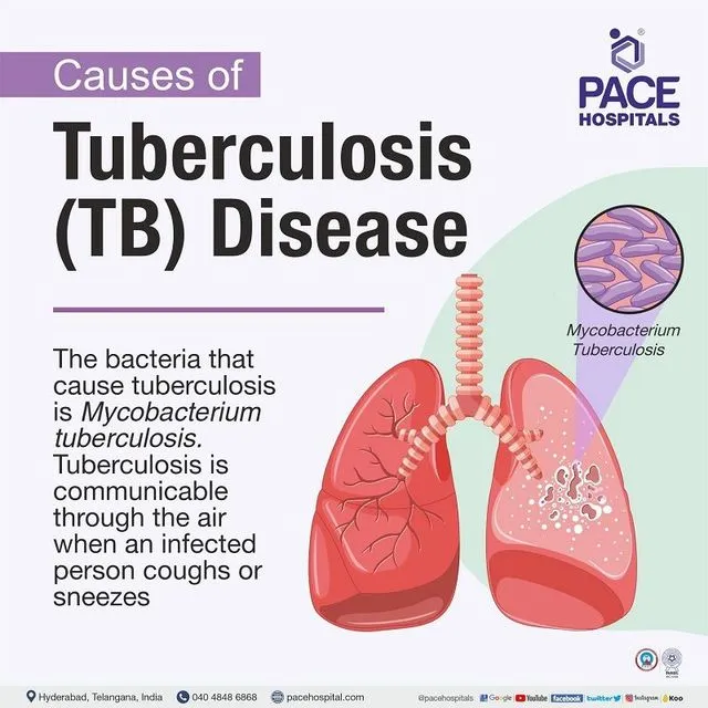 Tuberculosis symptoms